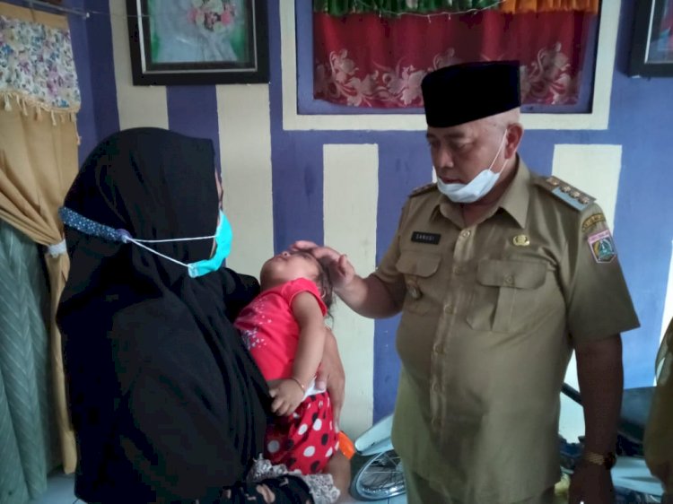 Bupati Malang, HM Sanusi saat menjenguk balita stunting di Gondanglegi/RMOLJatim