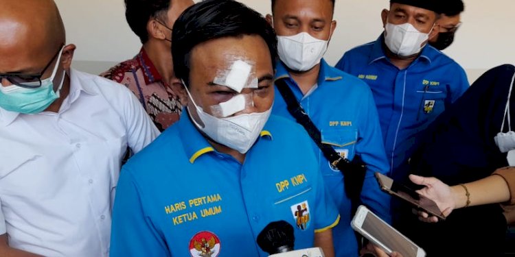 Ketua Umum Dewan Pengurus Pusat (DPP) Komite Nasional Pemuda Indonesia (KNPI), Haris Pertama/Net