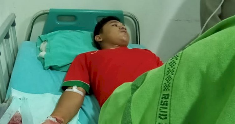 Korban Iqbal di ruang perawatan RSUD dr Harjono pasca terkena ledakan petasan jumbo/RMOLJatim