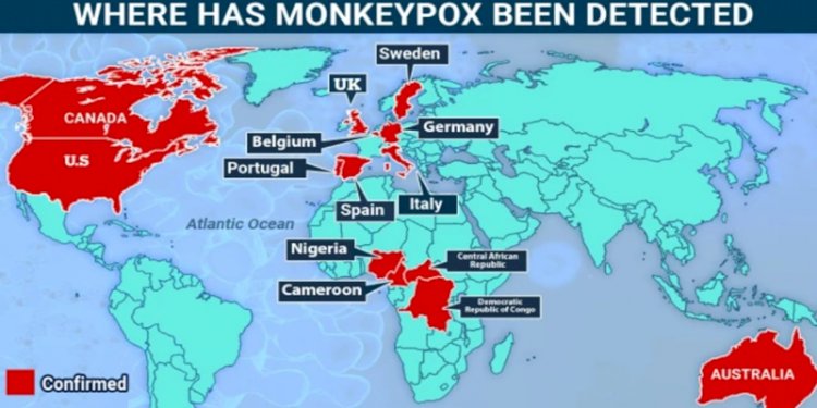 Cacar monyet terjadi di beberapa negara Afrika Tengah dan Barat, tetapi tahun 2022 penyebarannya semakin meluas/Net