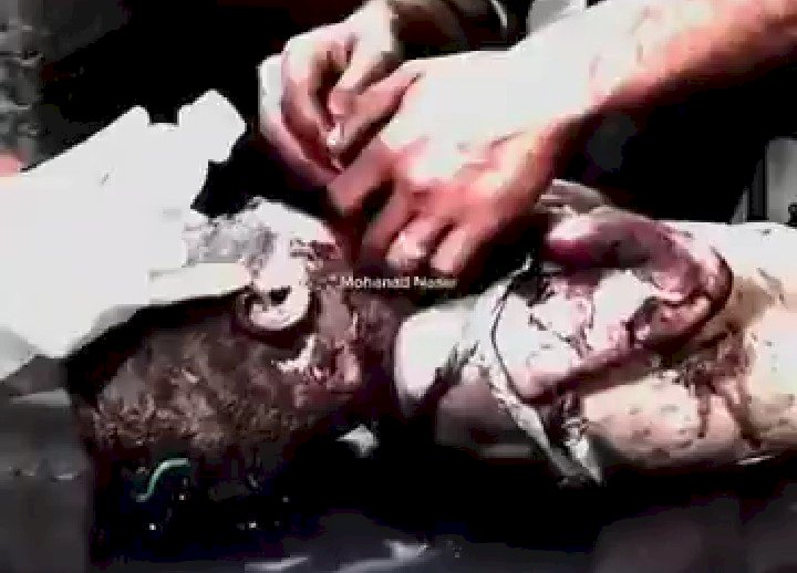 Seorang bayi di Rafah menjadi korban pengeboman zionis Israel/repro